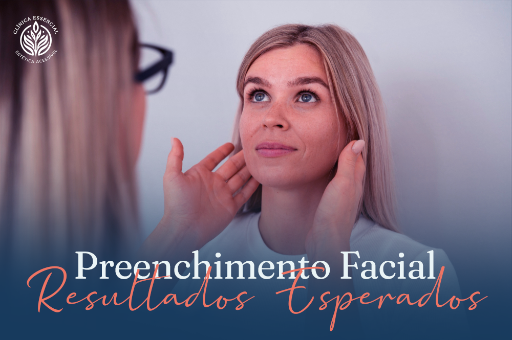 Resultado de preenchimento facial: pele lisa e rejuvenescida após procedimento na Essencial Estética.
