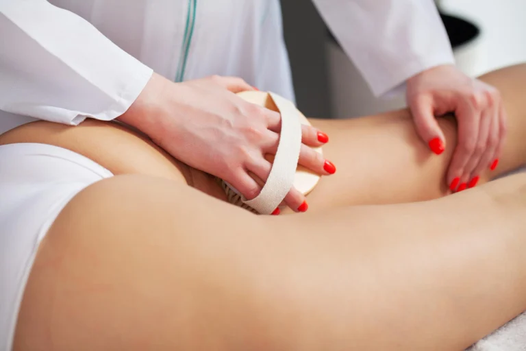 Profissional aplicando tratamento anti-celulite nas coxas de uma paciente na Clínica Essencial Estética