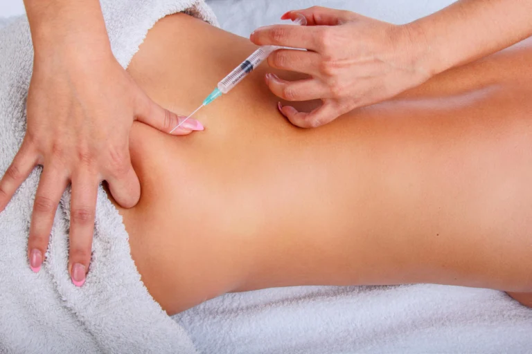 Profissional aplicando microagulhamento nas estrias da coxa de uma paciente na Clínica Essencial Estética.