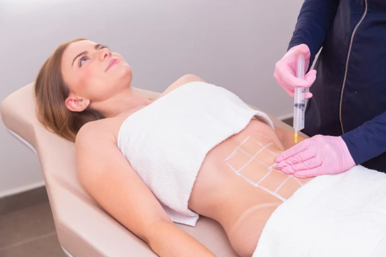 Profissional aplicando Carboxiterapia na Clínica Essencial Estética para redução de celulite nos glúteos.