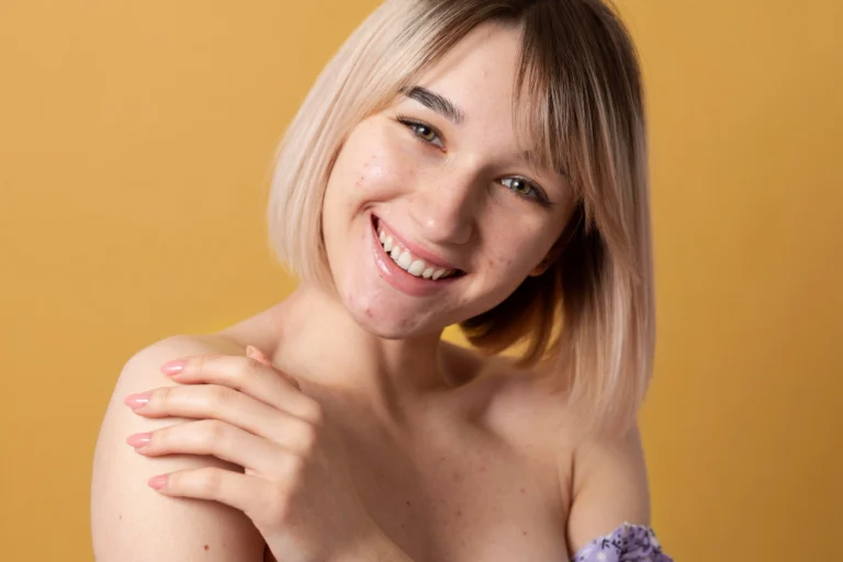 Mulher com pele uniforme e sem manchas após o tratamento Anti-Melasma Avançado na Clínica Essencial Estética