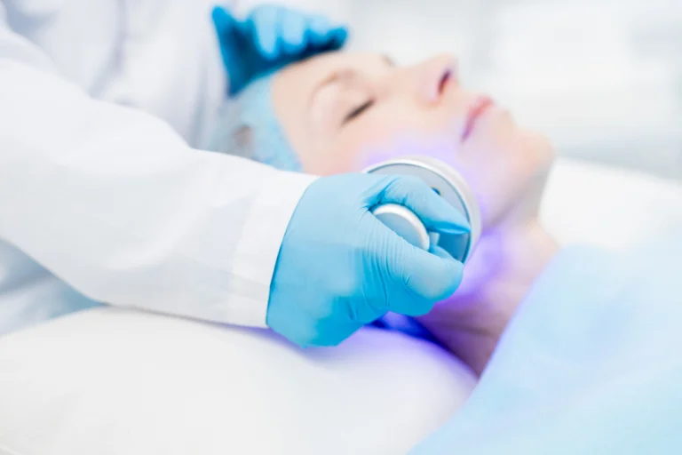Profissional aplicando luz pulsada em paciente para tratamento de acne ativa.