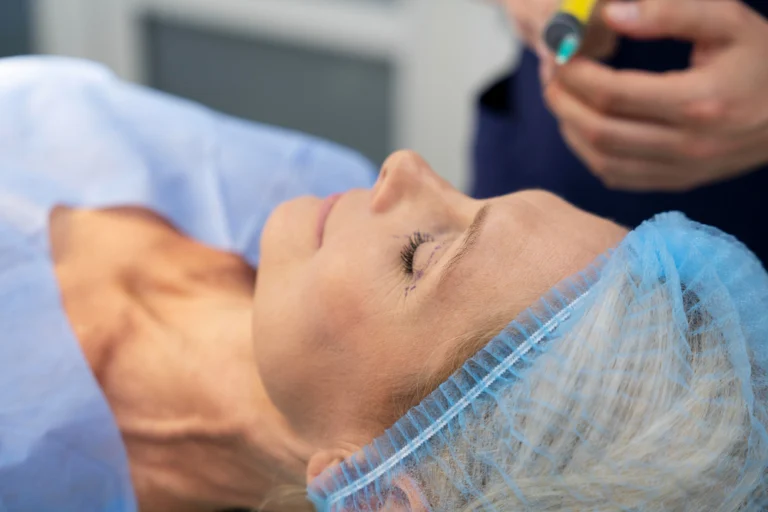 Aplicação de bioestimulador de colágeno para rejuvenescimento facial na Clínica Essencial Estética.