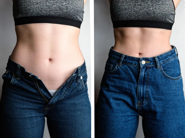 Antes e depois do tratamento Seca Barriga, mostrando a redução de medidas na região abdominal.
