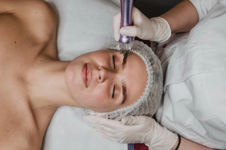 Profissional aplicando microagulhamento no rosto de uma paciente na Clínica Essencial Estética