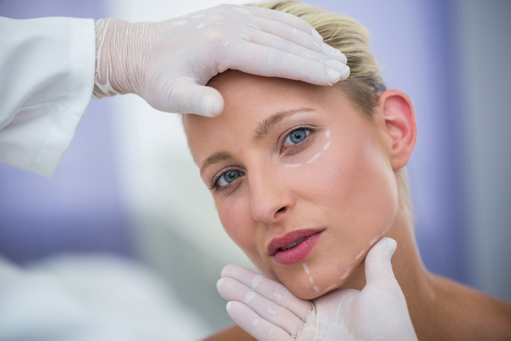 Aplicação de bioestimuladores de colágeno na Clínica Essencial Estética.