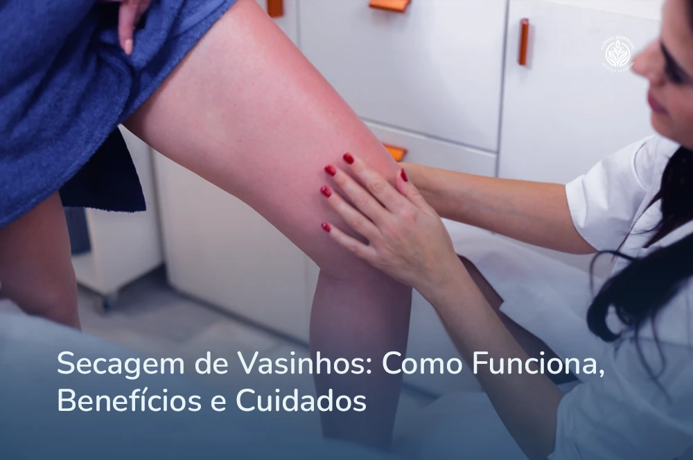 Mulher feliz após tratamento de secagem de vasinhos na Clínica Essencial Estética em São Paulo